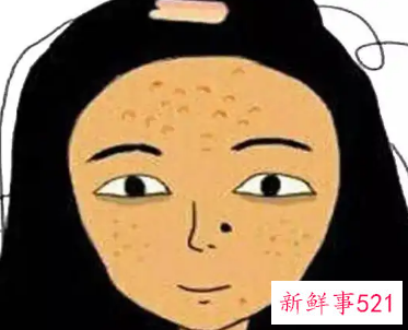 长期熬夜肌肤暗沉