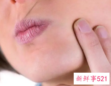 嘴角起泡要不要弄破