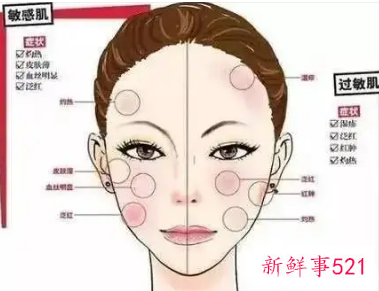 用化妆品面部皮肤过敏自救方法