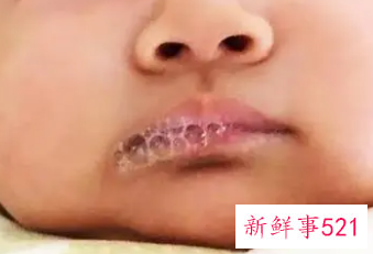 新生儿一直吐唾沫怎么回事