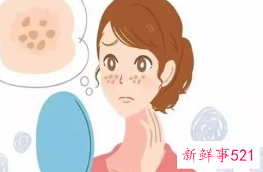 如何快速去除妊娠斑