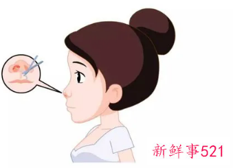 怎么能让鼻子变好看