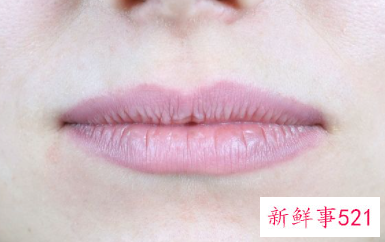 怎样去小胡子快速有效