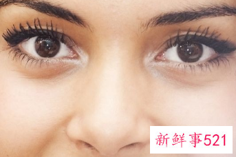 女人长期黑眼圈严重说明什么