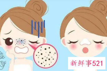 毛孔粗大怎么收缩毛孔