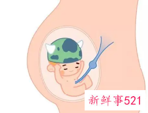 臀位一般会早产多久