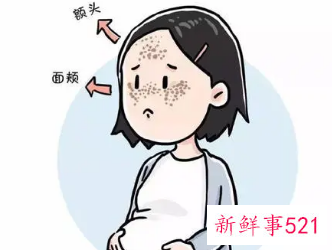如何快速去除妊娠斑
