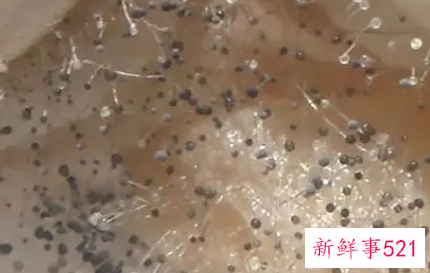 潮湿霉菌对人的危害