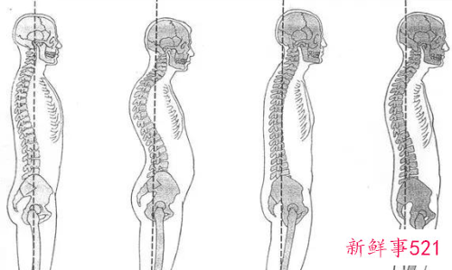 人体正常姿势的标准