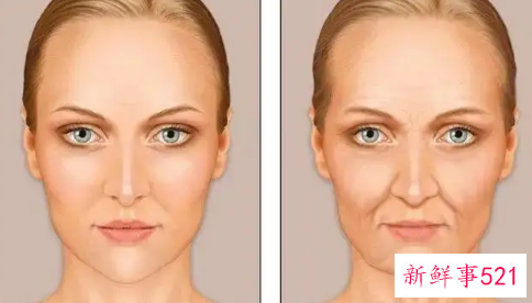 脸部往下垂怎么办