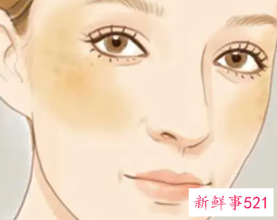 长期熬夜肌肤暗沉