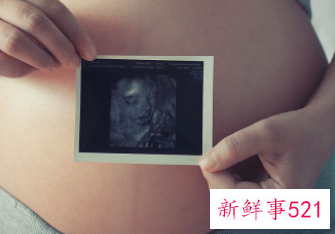 正确的孕周计算方法 末次月经