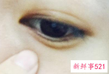 女人长期黑眼圈严重说明什么