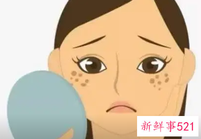 色斑淡化有效的方法