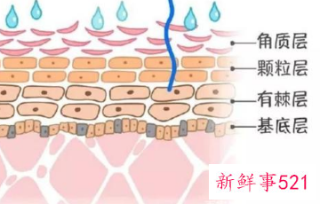 皮肤保护层受损表现