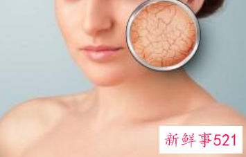 黑头毛孔大怎么办