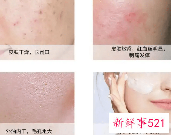 皮肤保护层受损表现