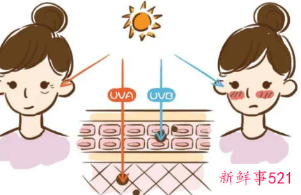 脸部皮肤老化怎么改善