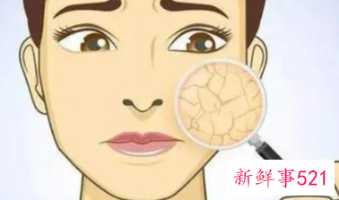 皮肤保护层受损表现