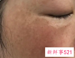 皮肤干没有光泽是什么原因