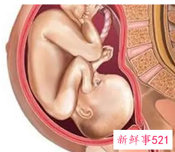 胎盘成熟度几级才能生