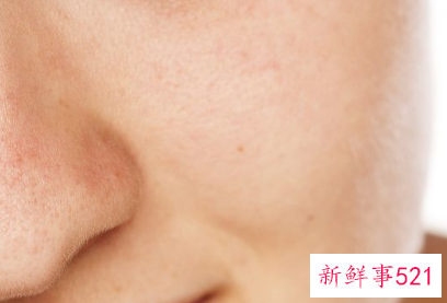 补水真的可以淡化色斑