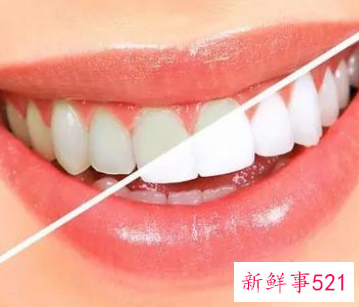 牙齿美白后该如何护理呢