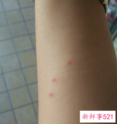 胳膊上有小红点怎么办
