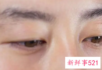 女人左眼皮跳是什么意思