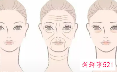 皱纹是怎么形成的