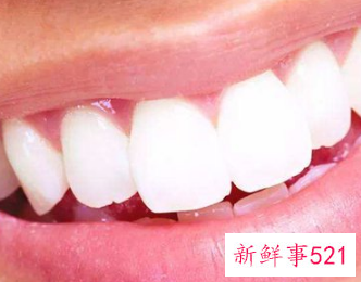 为什么早晚刷牙还是很黄