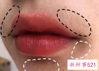 怎样防止唇部暗沉的情况