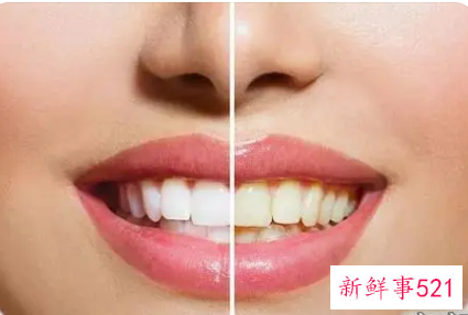 牙齿美白后该如何护理呢