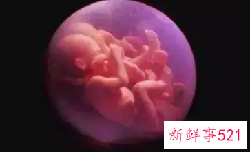 怀孕9个多月胎死腹中的征兆