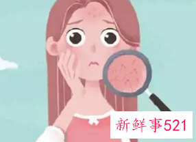 皮肤屏障怎么加快修复