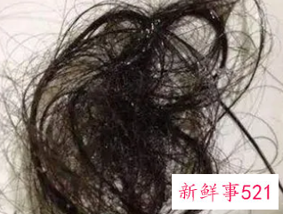 洗头发掉头发严重是什么原因女性