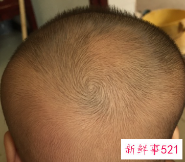 婴儿睡觉歪着头正常吗