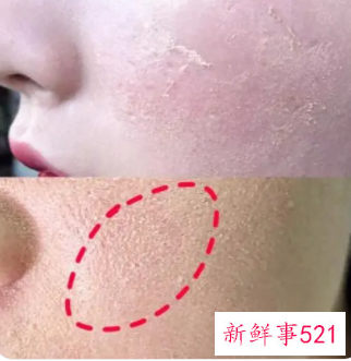 皮肤干没有光泽是什么原因