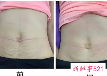 三天紧致肚子松弛方法