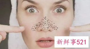 哪些偏方可以去除黑头