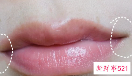怎样防止唇部暗沉的情况