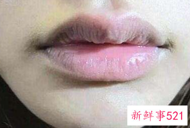 怎样防止唇部暗沉的情况