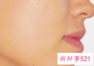 面部抗衰活动主题