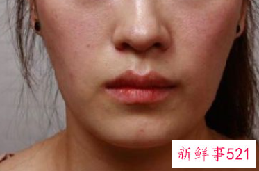 面部抗衰活动主题