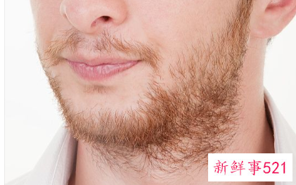 男士的脸两边的胡子怎样永久去除