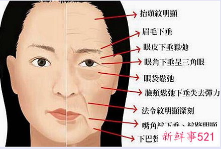 女性各年龄段出现的面部皱纹