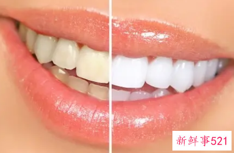 如何美白自己的牙齿