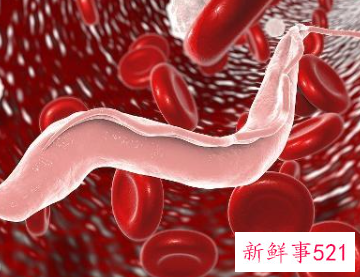 长期久坐不动会怎么样