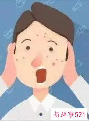 哪种痘痘是内分泌失调吃什么维生素