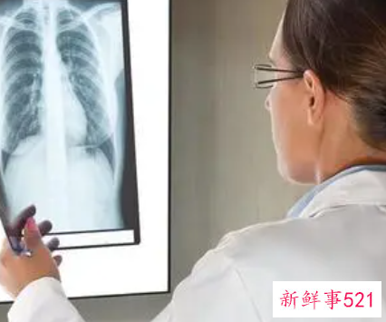 常照X光会诱发荨麻疹